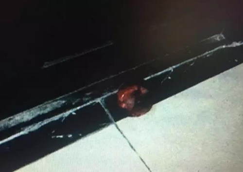 女子門口被放心臟