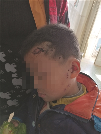 男孩被二哈撲咬