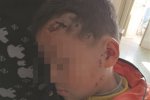男孩被二哈撲咬受傷