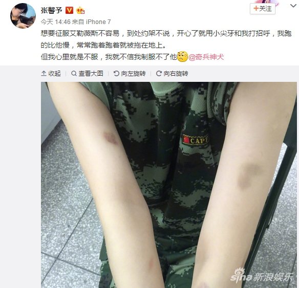 張馨予訓狗慘被咬