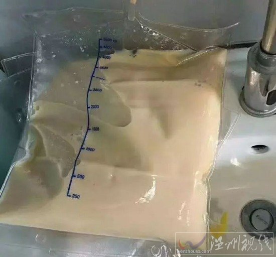 姑娘血漿成豬油色