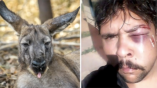 男子打獵遭袋鼠揍