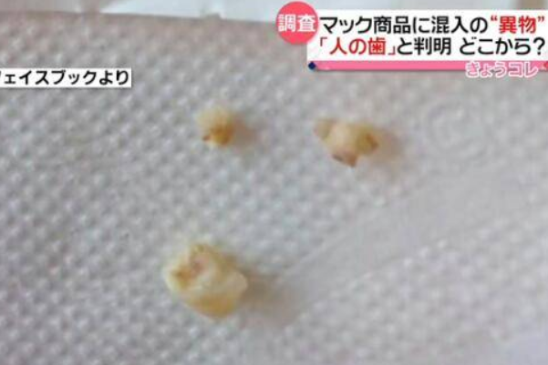 麥當(dāng)勞吃出3顆牙