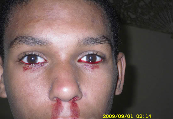 外國男子眼流血淚