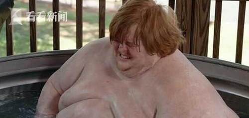 美國男子重640斤