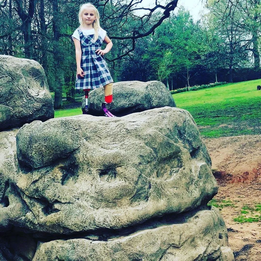 截肢仙女紅遍全球