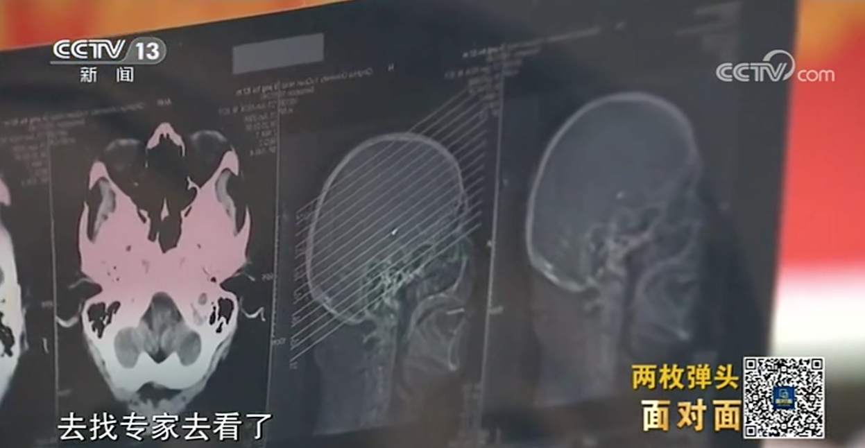 抗美援朝老兵骨灰里發(fā)現(xiàn)子彈頭