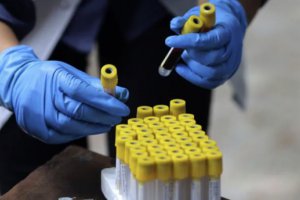 德國實(shí)驗(yàn)室測試發(fā)現(xiàn)某些抗體療法對(duì)Omicron變種無效